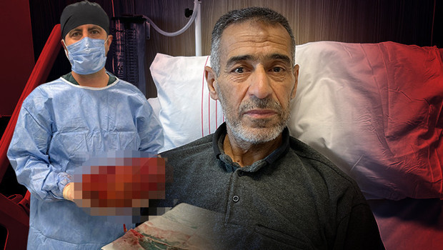 Ağrı şikayeti ile gitti, varılan teşhis doktorları da hayrete düşürdü | ‘Normalde yarım kilo yoktur, benimki 8 kiloya ulaşmıştı’