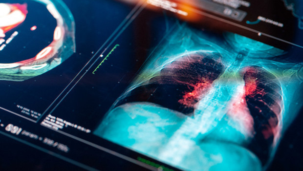 Akciğerde çığır açan keşif: Hücrelerin ‘onarım düğmesi’ bulundu! ‘Süreci tersine çevirebilme potansiyeli taşıyor’