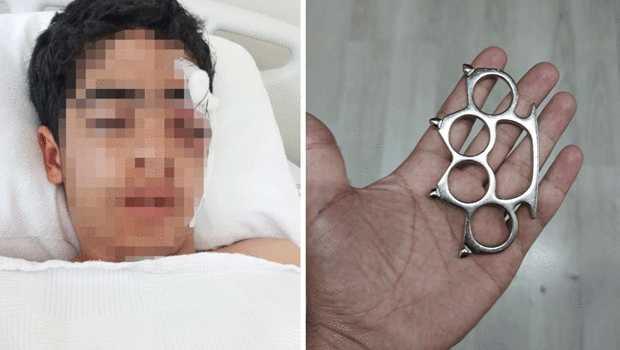 Esenyurt’ta dehşet! 15 yaşındaki çocuk ‘Bana şaka yapma’ dediği arkadaşı tarafından muştayla öldüresiye dövüldü