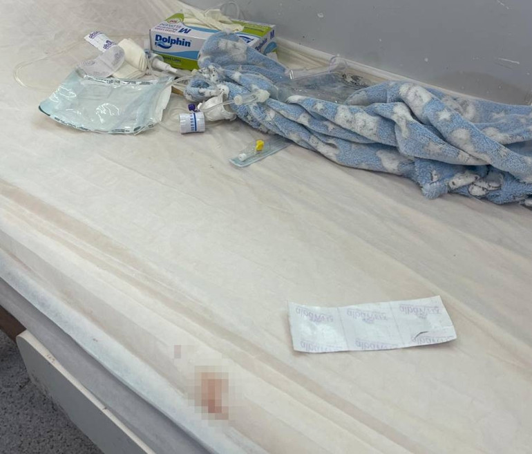 Hemşire, makasla sargıyı keserken bebeğin parmağını kopardı